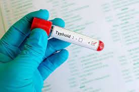 Typhoid Fever